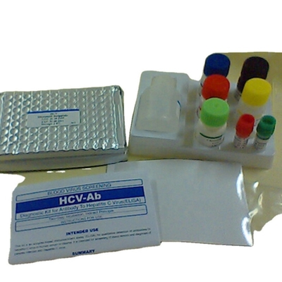 Interleukin 1 Beta elisa Detection Kit Human Il1b Elisa Kit Reaserch Use